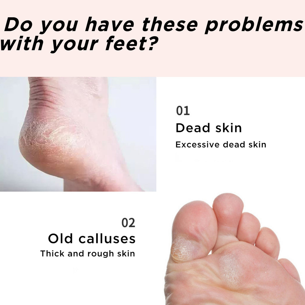 2x Foot Care Pumice Sponge Callus Exfoliate Hard/Dead Skin Remove